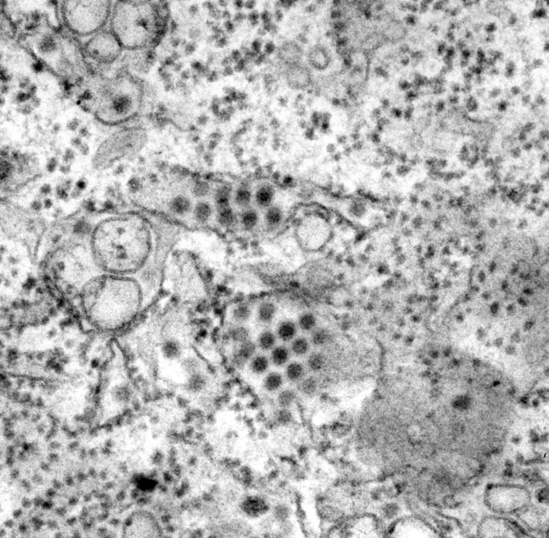 Image en microscopie électronique à transmission de particules du virus de la dengue